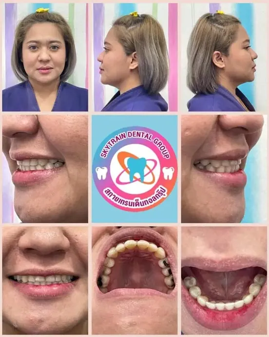 ตัวอย่างภาพถ่ายสำหรับปรึกษา