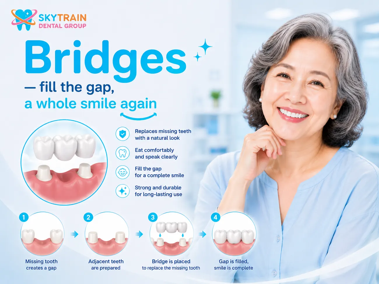 Dental Bridges สกายเทรน เด็นทัล
