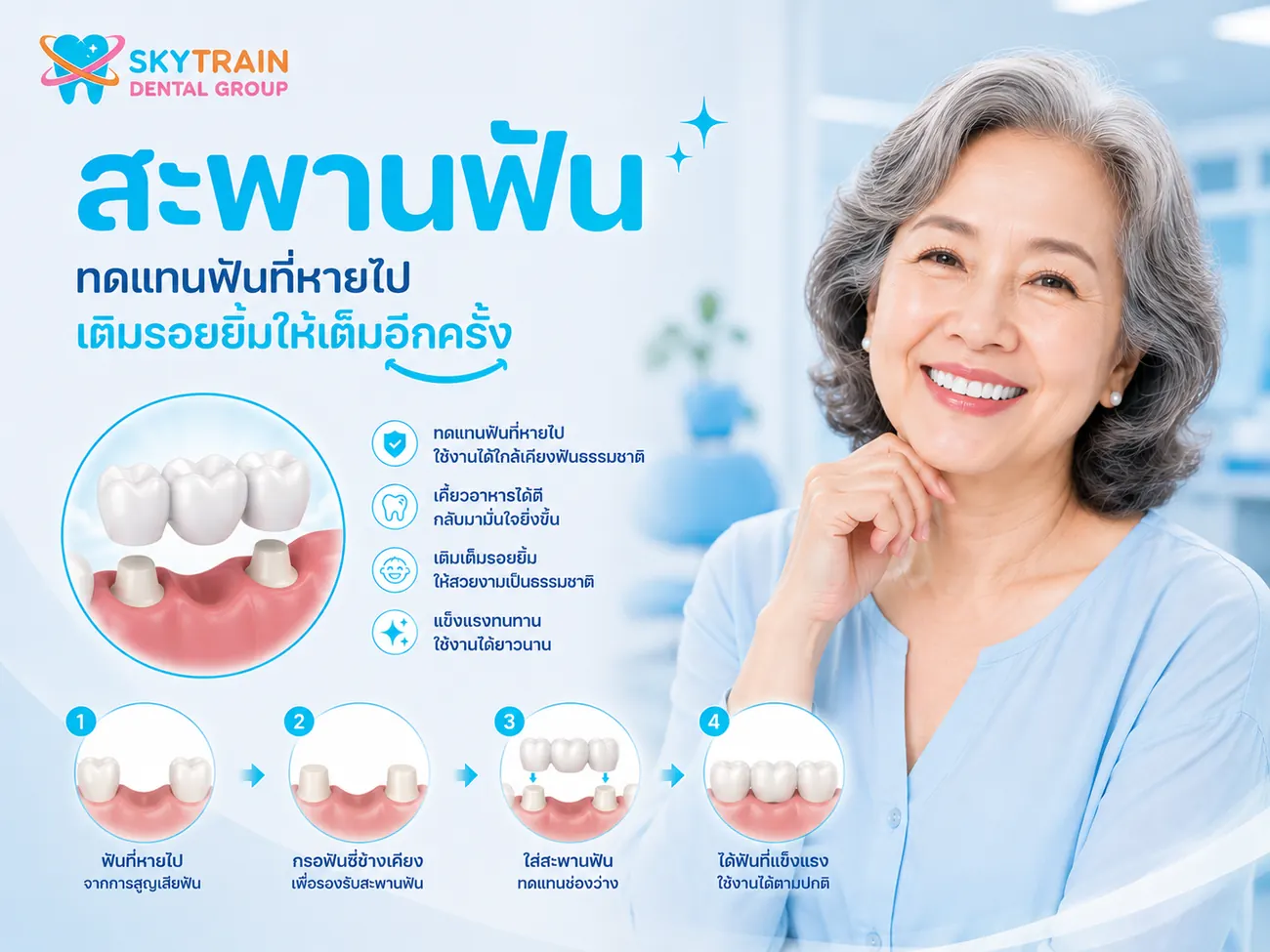 สะพานฟัน สกายเทรน เด็นทัล