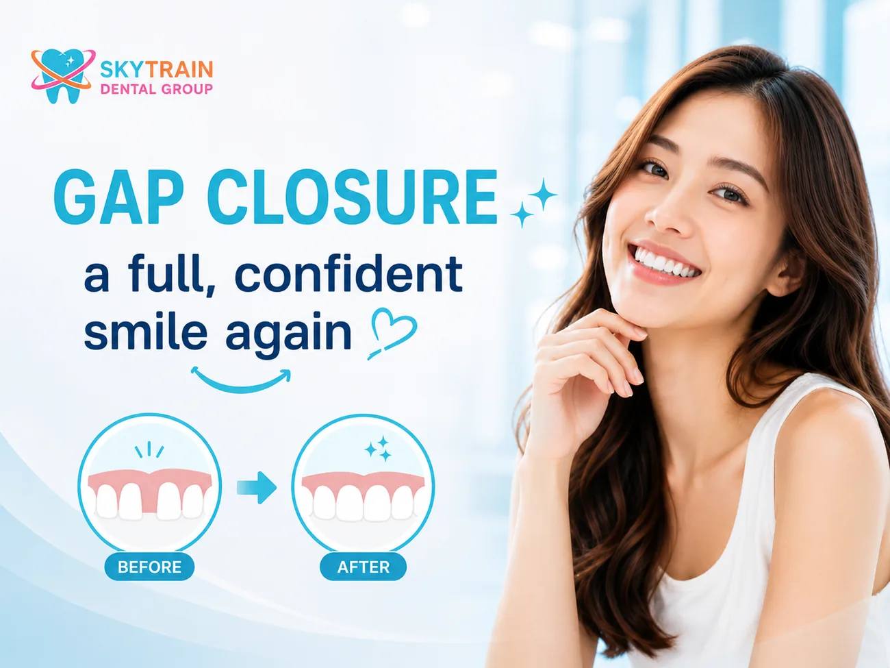 Gap Closure สกายเทรน เด็นทัล