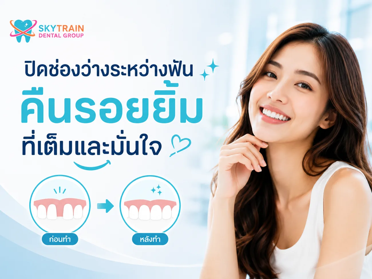 ปิดช่องว่างฟัน สกายเทรน เด็นทัล