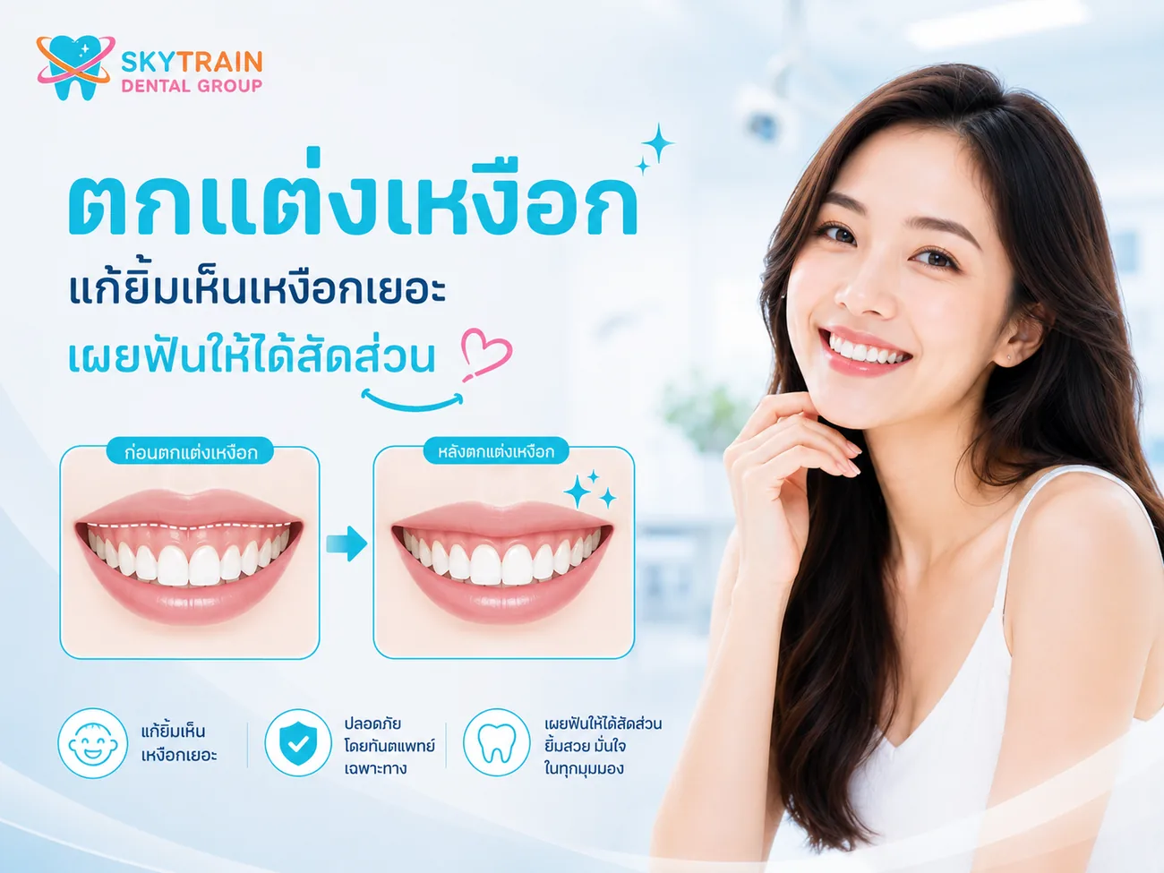 ตกแต่งเหงือก สกายเทรน เด็นทัล