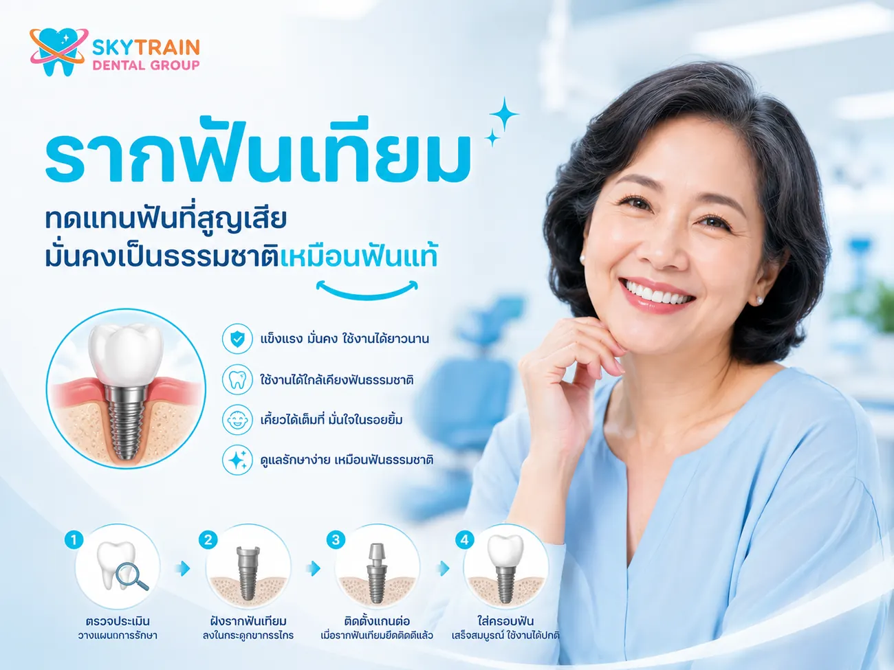 รากฟันเทียม สกายเทรน เด็นทัล