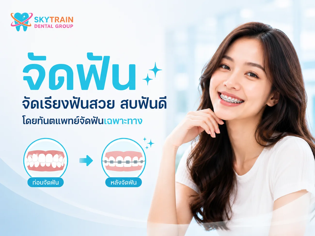 จัดฟัน สกายเทรน เด็นทัล