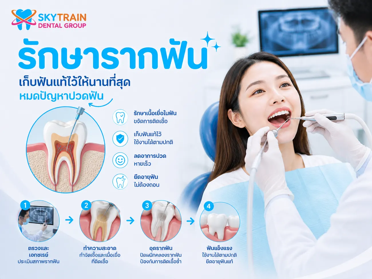 รักษารากฟัน สกายเทรน เด็นทัล
