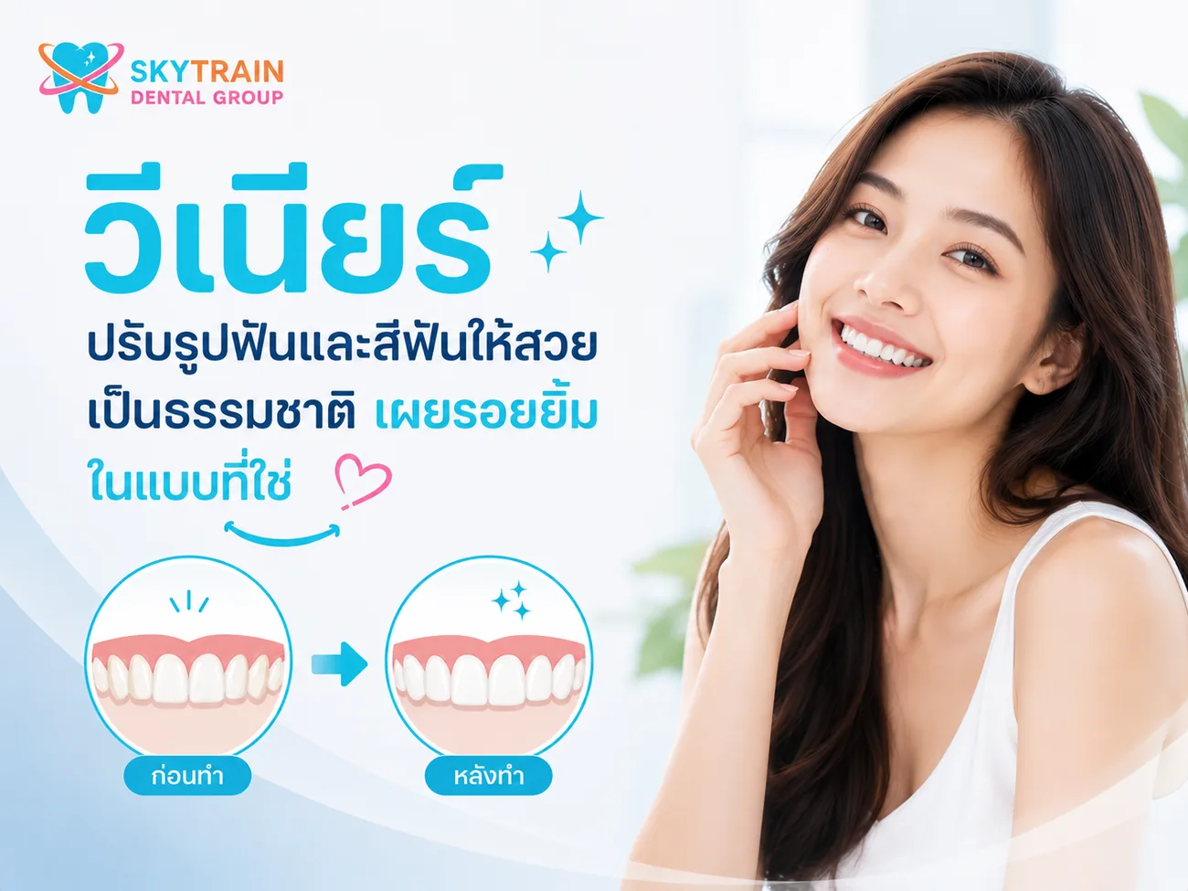 วีเนียร์ สกายเทรน เด็นทัล
