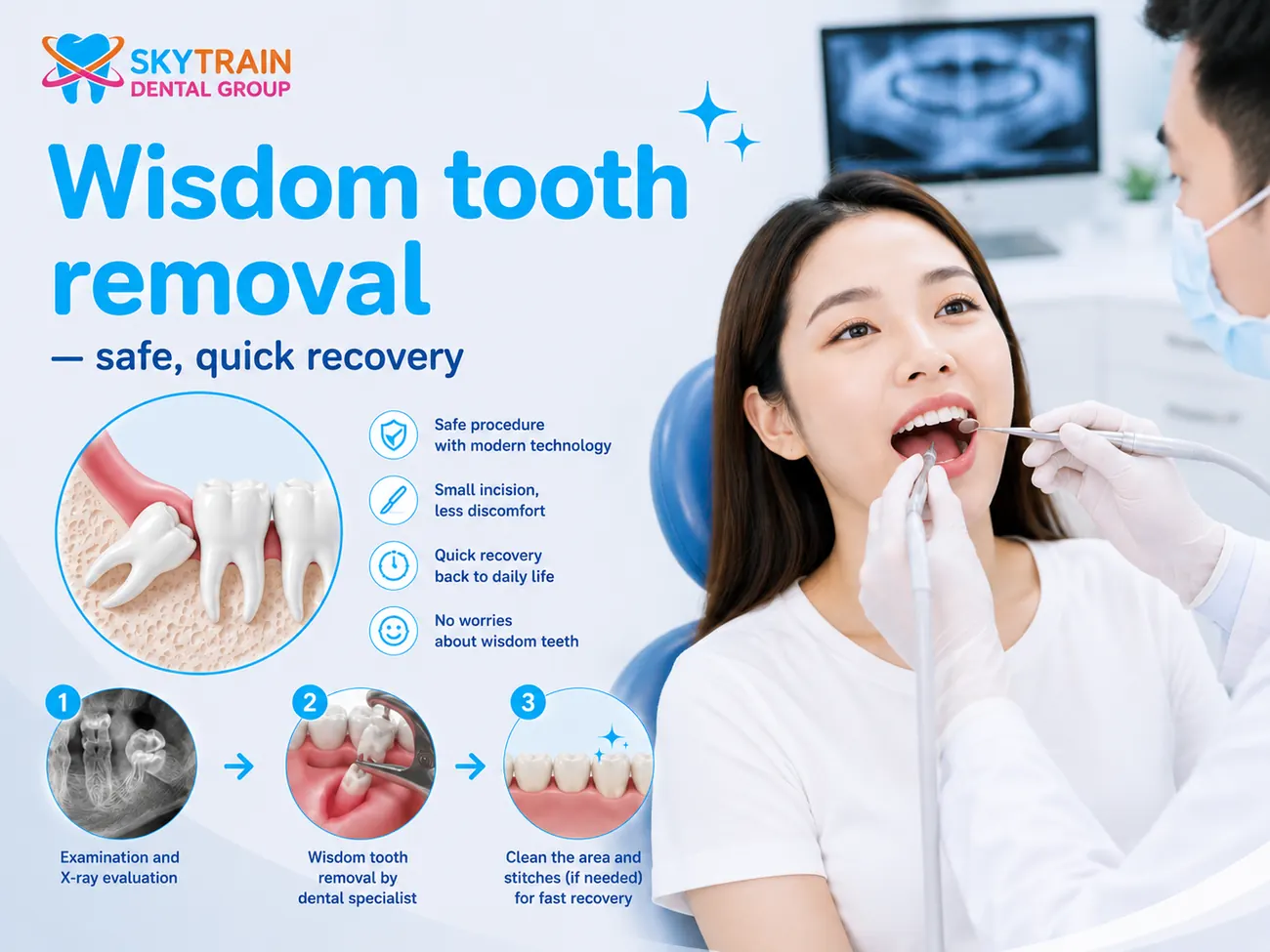 Wisdom Tooth Surgery สกายเทรน เด็นทัล