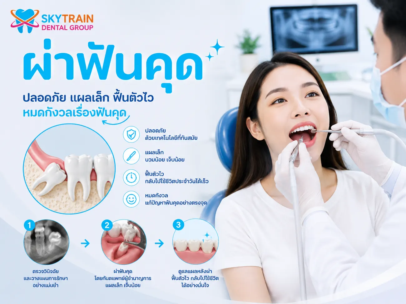 ผ่าฟันคุด สกายเทรน เด็นทัล