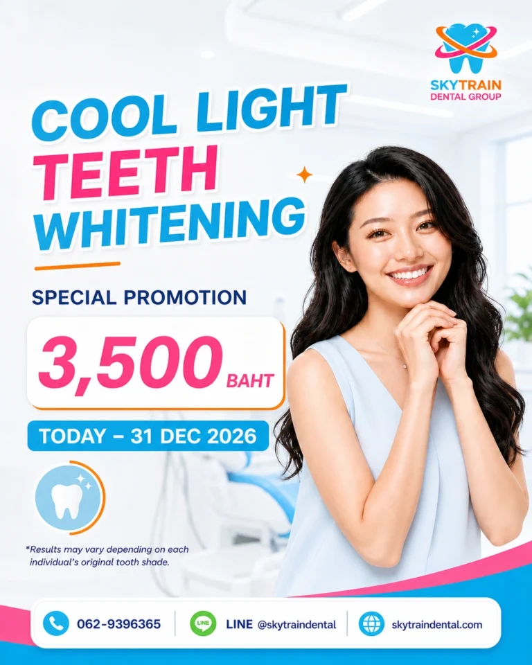 Cool Light Teeth Whitening