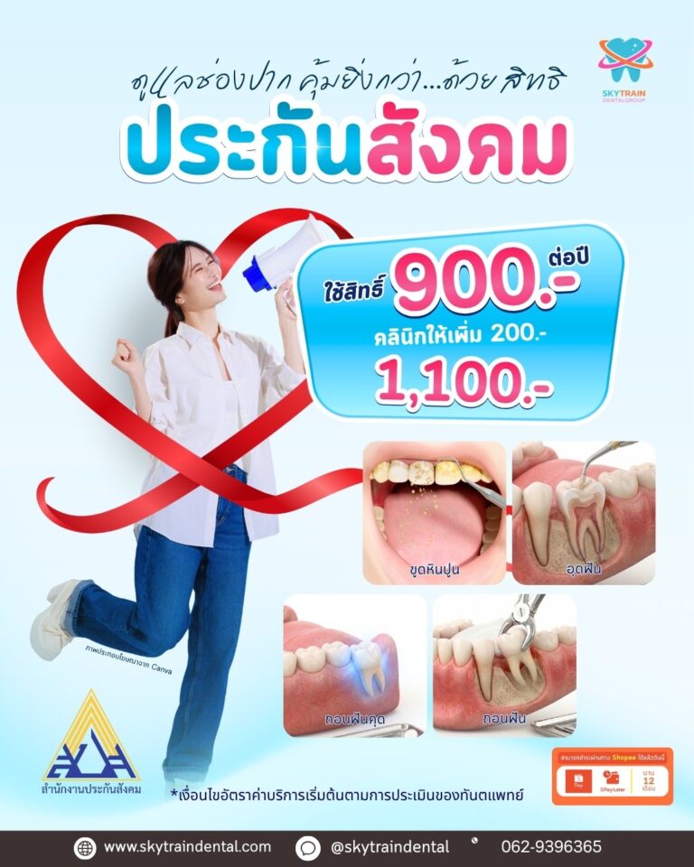 ทำฟันประกันสังคม