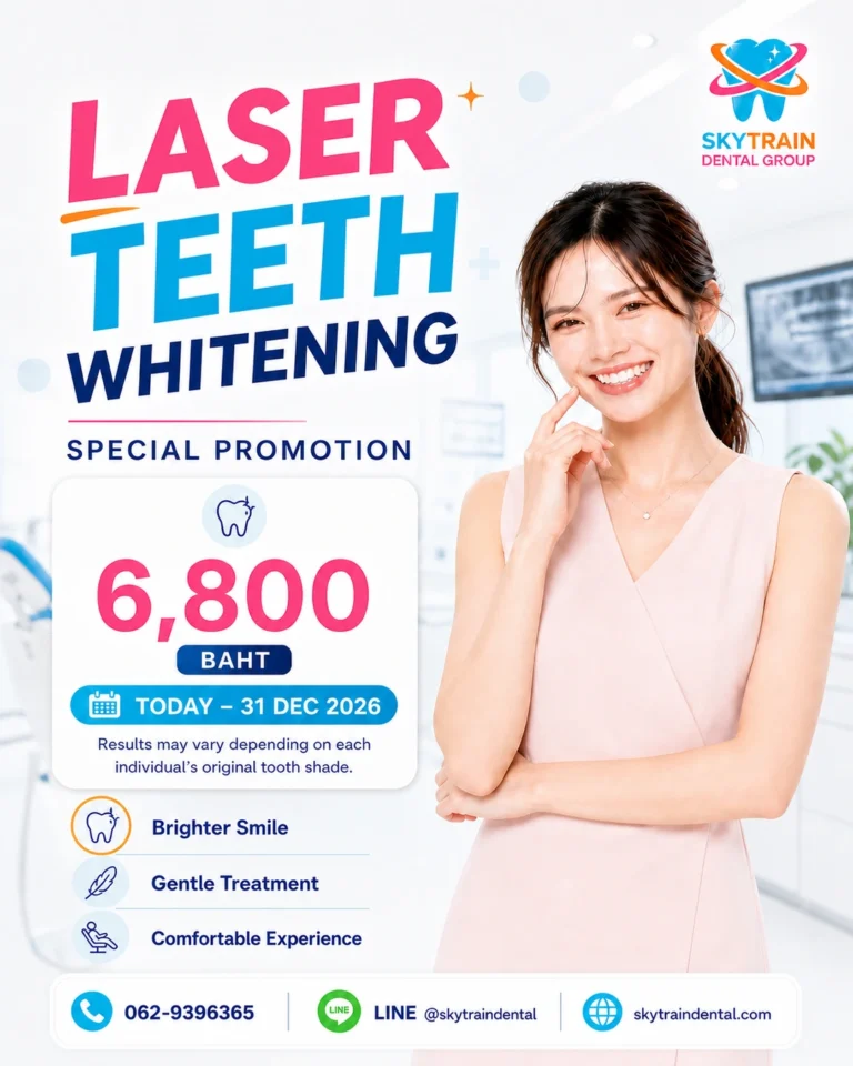 Laser Teeth Whitening